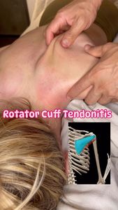 Instagram post by @prehabandrecovery