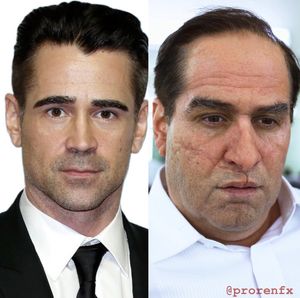 Instagram post by @prorenfx