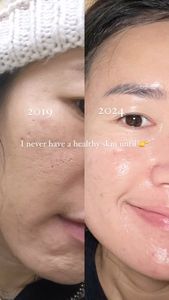 Instagram post by @ninewchawika