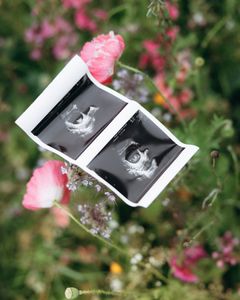 Instagram post by @warnerscorner