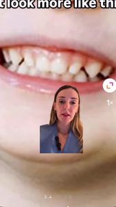 Instagram post by @pediatric.dentist.mom