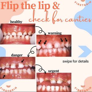 Instagram post by @pediatric.dentist.mom