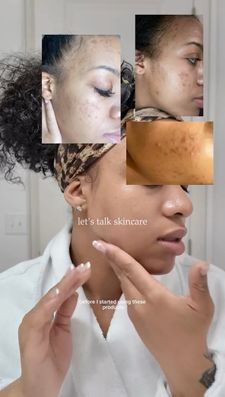 Instagram post by @kaynaturalz