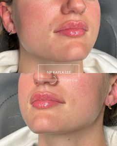 Instagram post by @np_kayla_lee