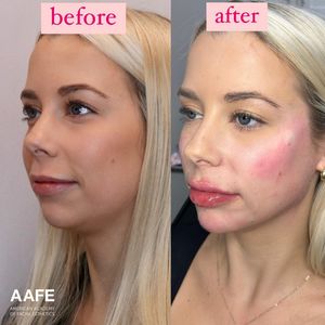 Instagram post by @thefacialplanner