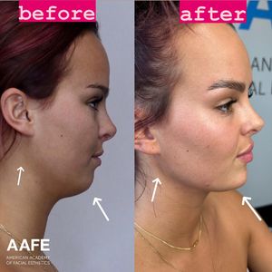 Instagram post by @thefacialplanner