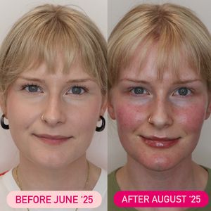 Instagram post by @thefacialplanner