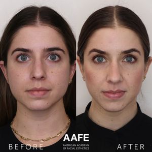 Instagram post by @thefacialplanner