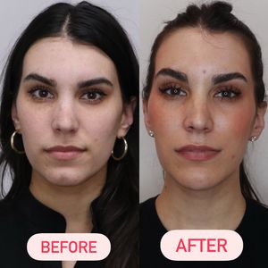 Instagram post by @thefacialplanner