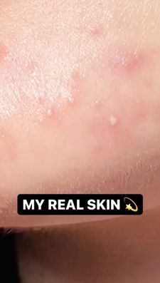 Instagram post by @melodykingglows