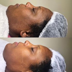 Instagram post by @theskincarehacker