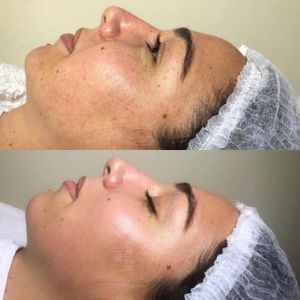 Instagram post by @theskincarehacker