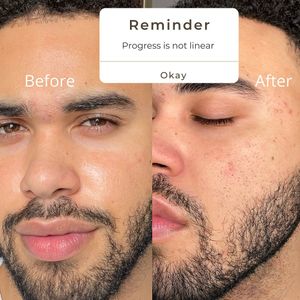 Instagram post by @glowinwithanthony