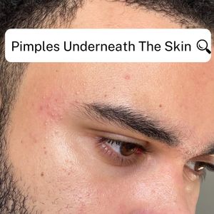 Instagram post by @glowinwithanthony