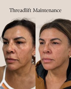 Instagram post by @thebeautypa