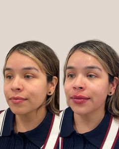 Instagram post by @thebeautypa