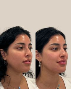 Instagram post by @thebeautypa