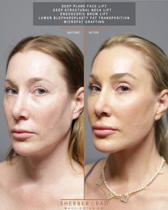 Instagram post by @drarielrad