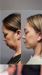 Instagram post by @drarielrad