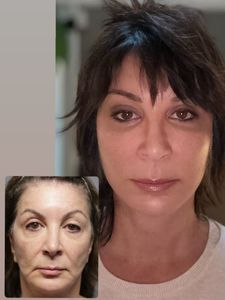 Instagram post by @drarielrad