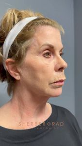 Instagram post by @drarielrad