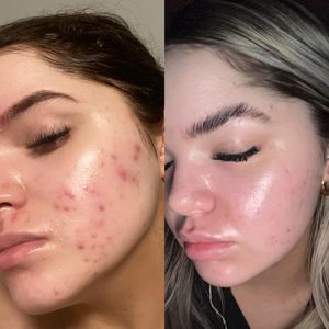 Instagram post by @skinwithbrooke