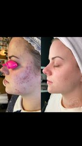 Instagram post by @lyssskin