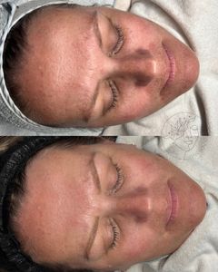 Instagram post by @lyssskin