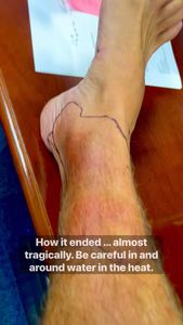 Instagram post by @robchapmanfishing