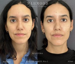 Instagram post by @hartzaesthetics