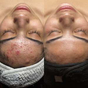 Instagram post by @pinnaclemodernskincare