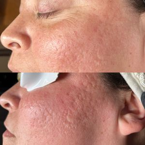 Instagram post by @pinnaclemodernskincare