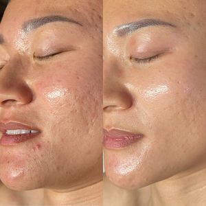 Instagram post by @pinnaclemodernskincare