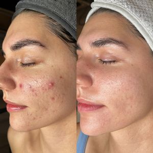 Instagram post by @pinnaclemodernskincare