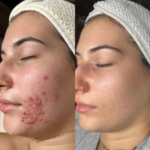 Instagram post by @pinnaclemodernskincare