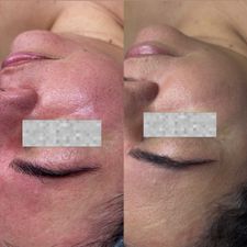 Instagram post by @saviskinn