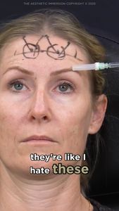 Instagram post by @injectionexpert