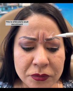 Instagram post by @injectionexpert