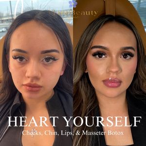 Instagram post by @selma_vlinebeautyclinic