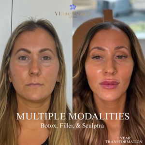 Instagram post by @selma_vlinebeautyclinic