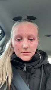 Instagram post by @denverskindoc