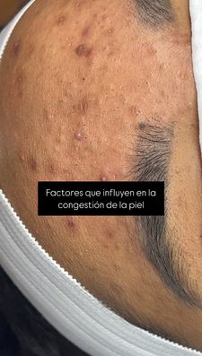 Instagram post by @peskinlaser