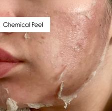 Instagram post by @peskinlaser